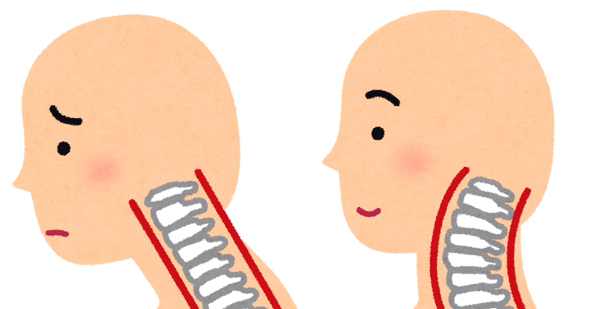 のれん クランシー に話す ストレート ネック リンパ Omutamachikyo Jp